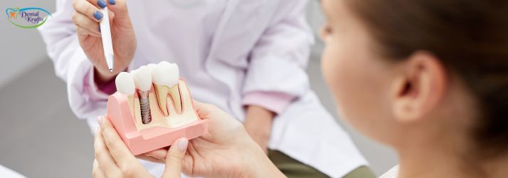 Tips for Dental Implant Surgery
