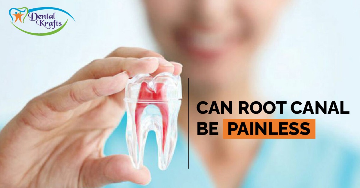 Can Root Canal be Painless