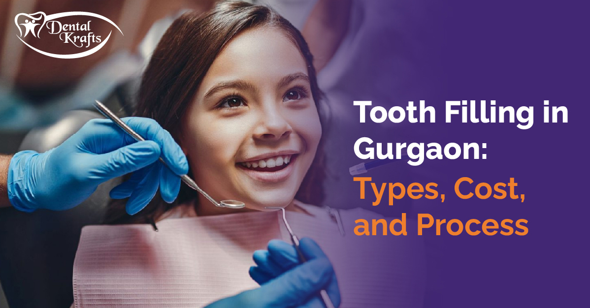 Tooth Filling in Gurgaon