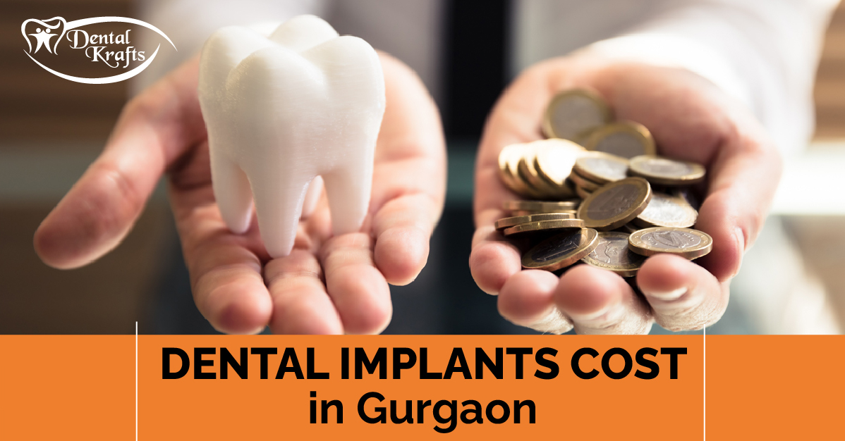 Dental Implants Cost in Gurgaon