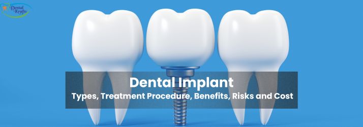 Types, Treatment Procedure, Benefits, Risks & Cost