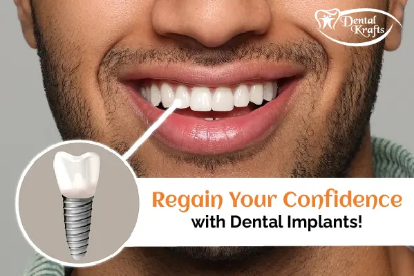 Regain Your Confidence with Dental