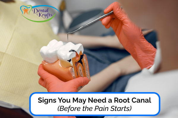 Signs You May Need a Root Canal