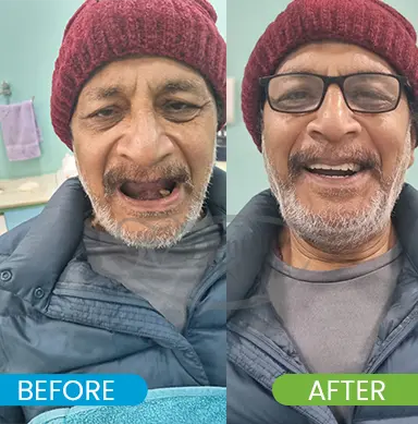 Dentures Treatment Gurgaon