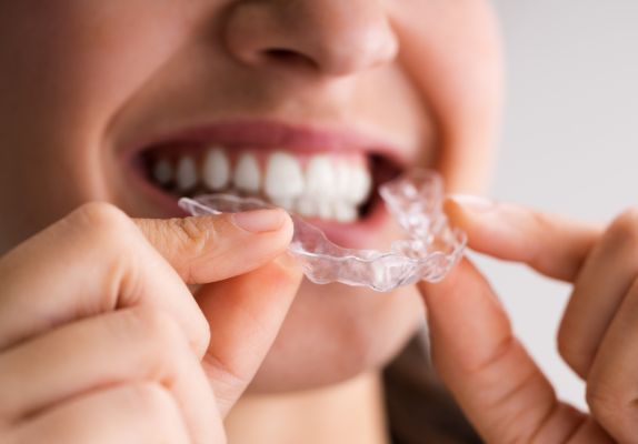 invisalign treatment in gurgaon