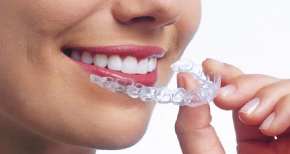 Best Invisible Aligners Gurgaon