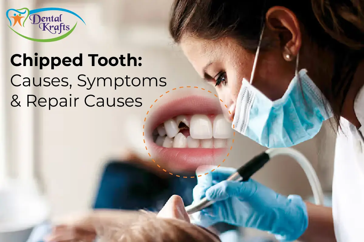 chipped tooth