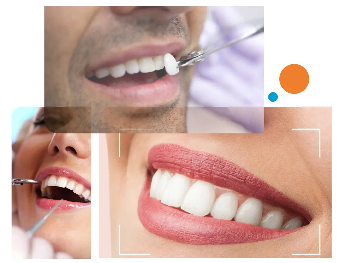 cosmetic dentist in gurgaon