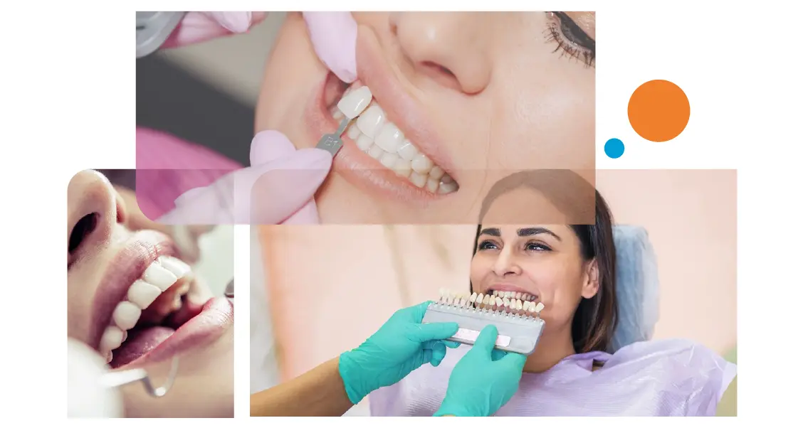 Dental Crowns in Gurgaon