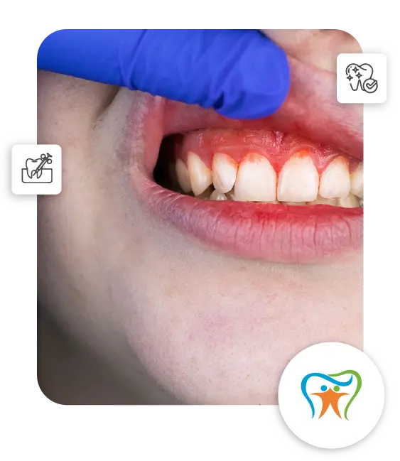 gum disease treatment at dental krafts