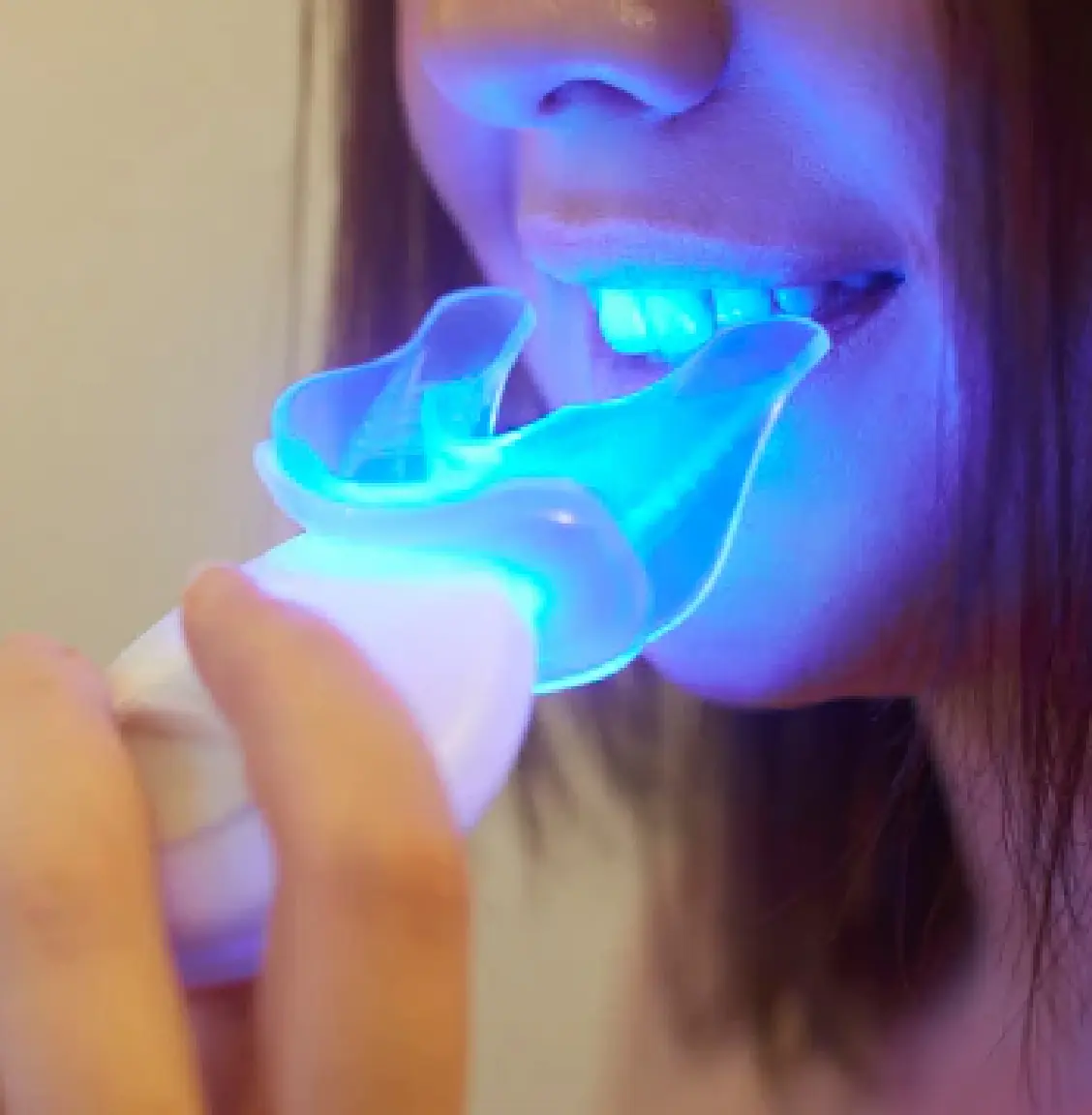 Teeth Whitening treatment gurgaon