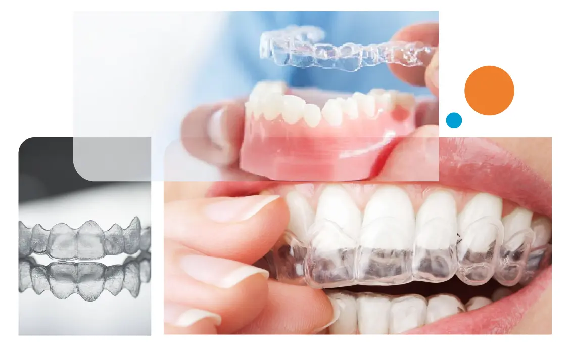 Invisalign Braces in Gurgaon