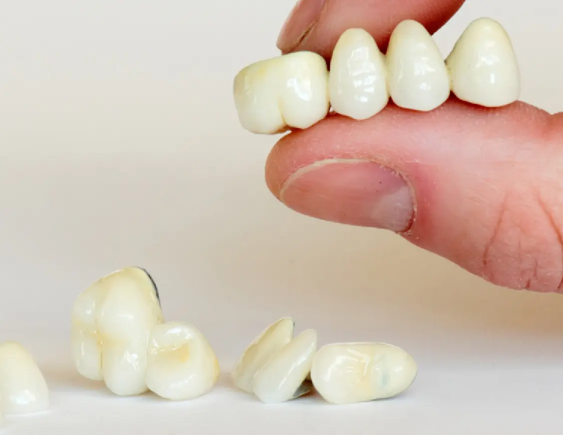 dental crowns gurugram
