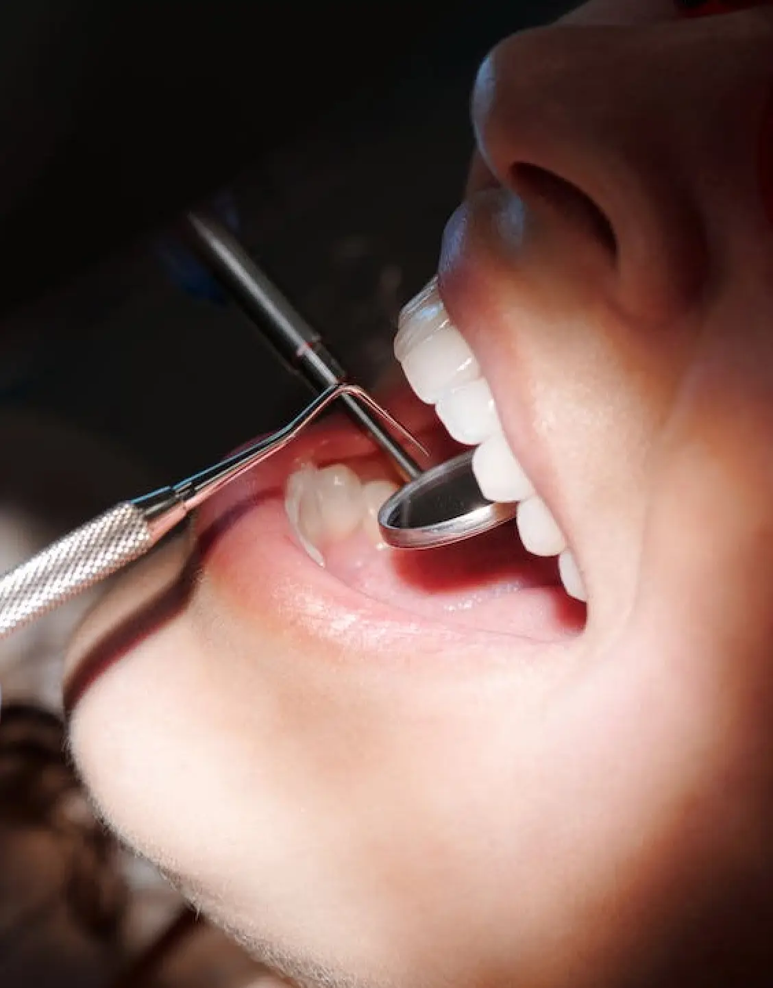 dental crown treatment in gurugram