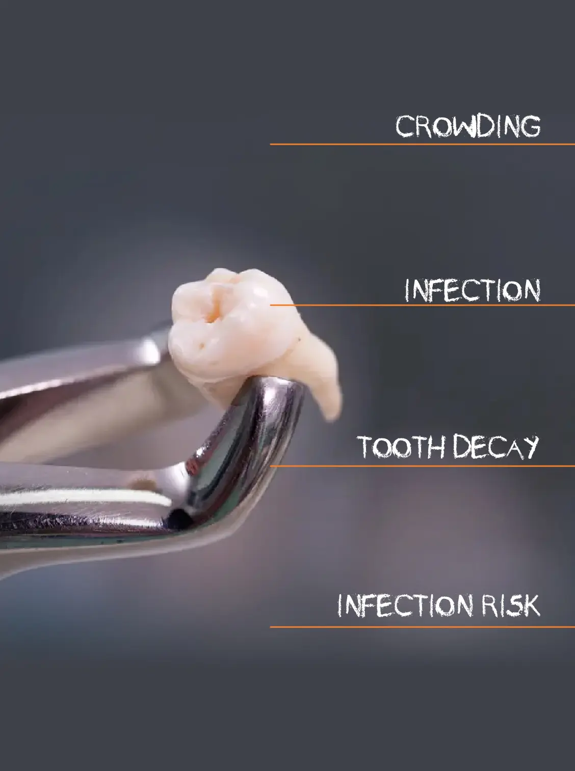 why wisdom teeth need to be removed