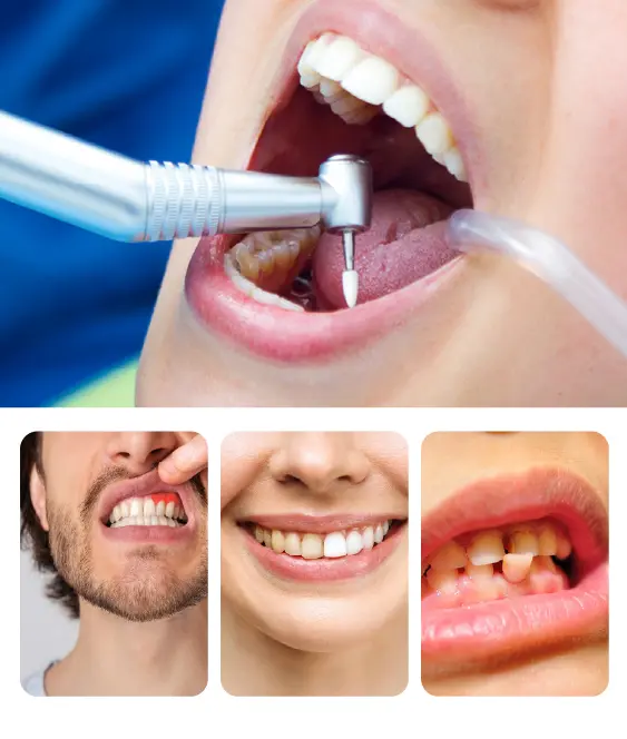 Who is Not Eligible for Root Canal Treatment
