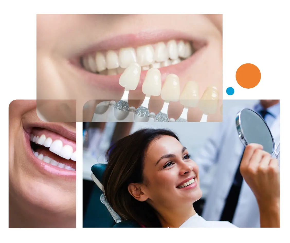 Smile designing In Gurgaon