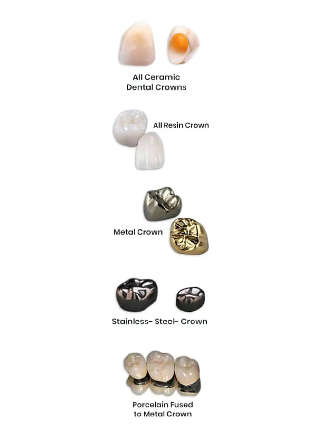 best dental crown treatment gurgaon