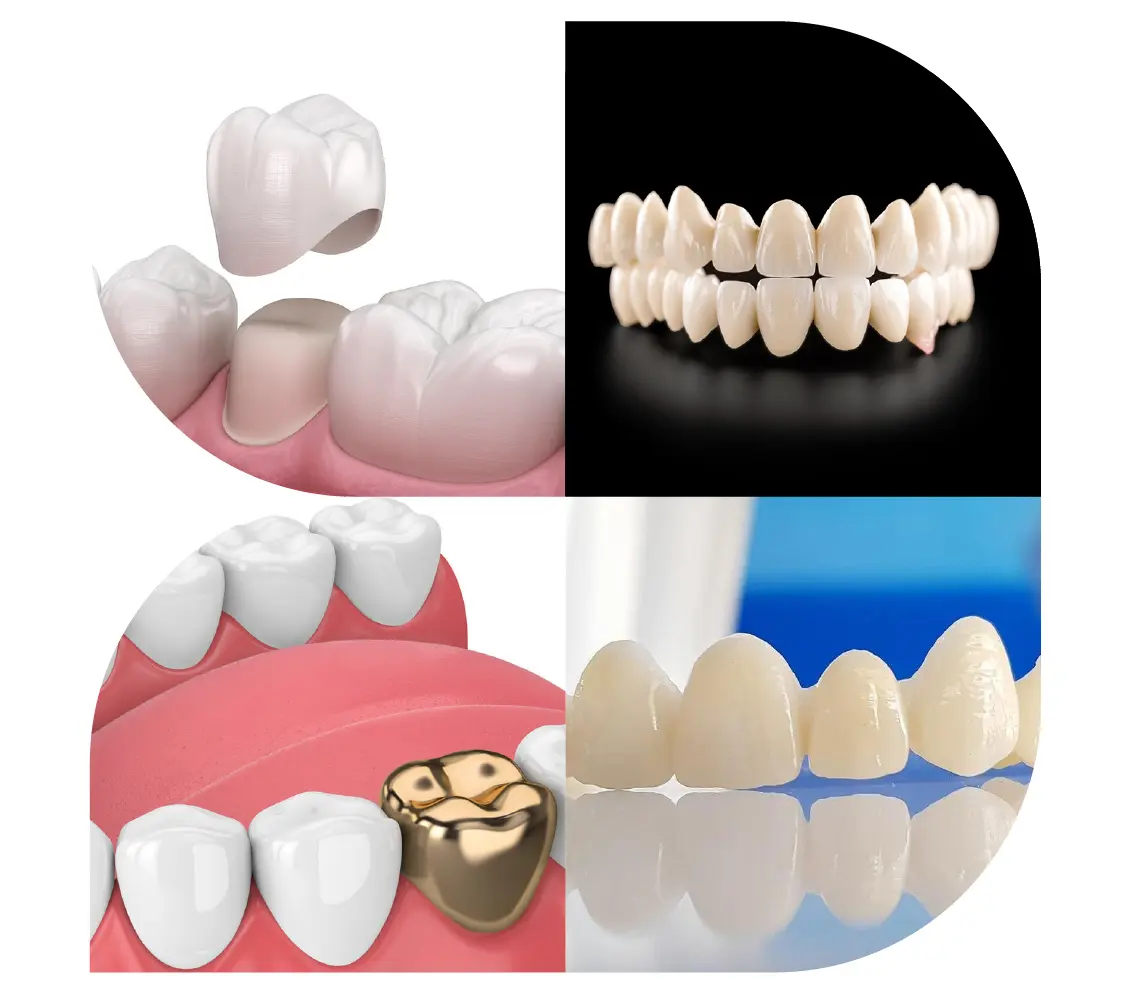dental services in gurgaon