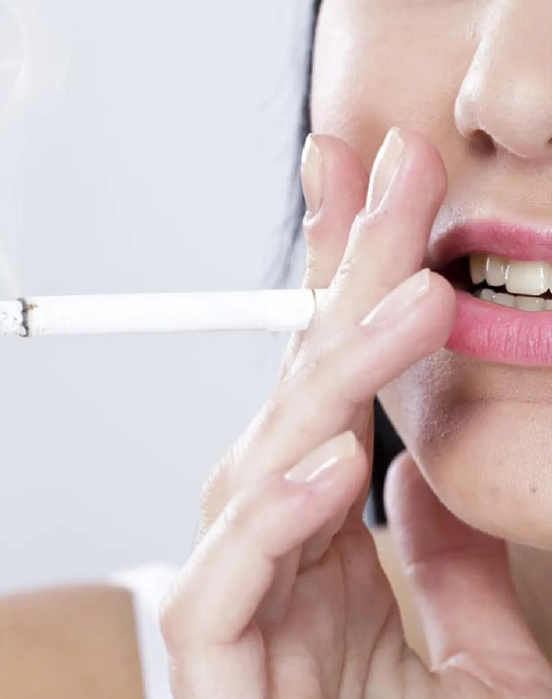 Teeth discolouration