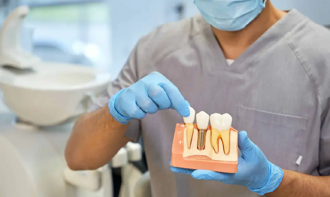importance of dental implants