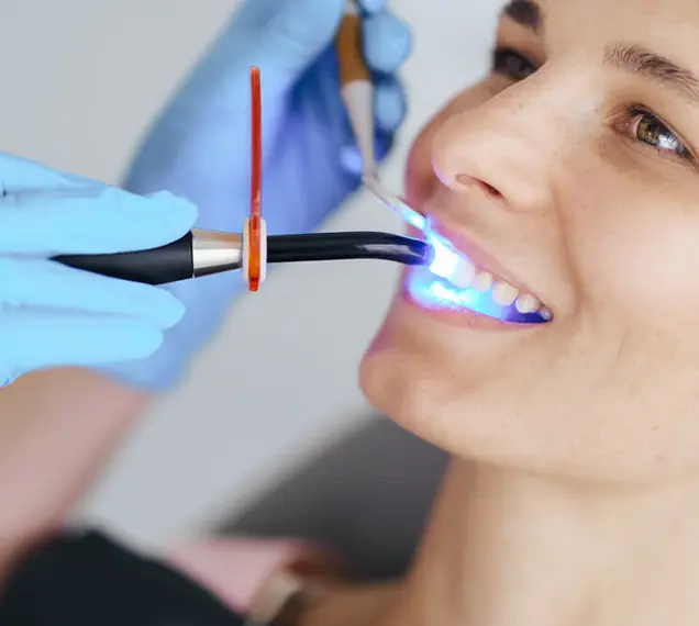 Laser dentistry treatment on a patient's teeth at Dental Krafts Gurgaon