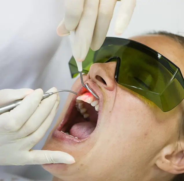 Laser treatment being applied on gums with protective glasses