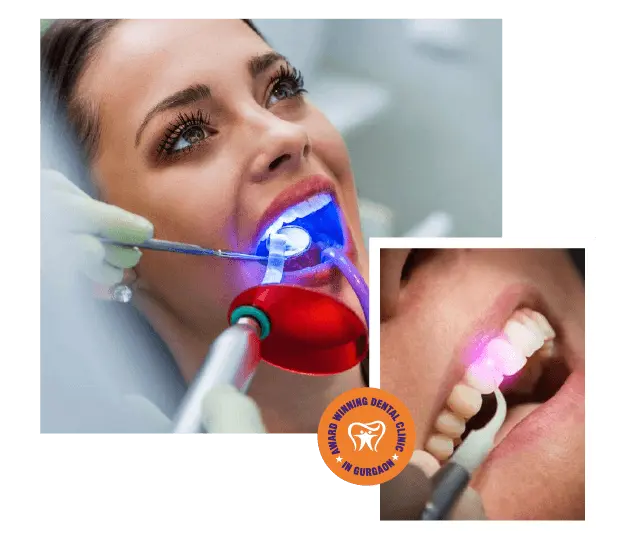 Laser dentistry treatment at Dental Krafts Gurgaon
